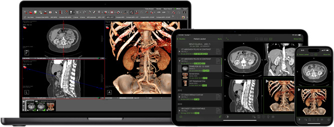 Software que muestra la app Visage, utilizada en radiología para interpretar archivos de diagnóstico de gran tamaño.