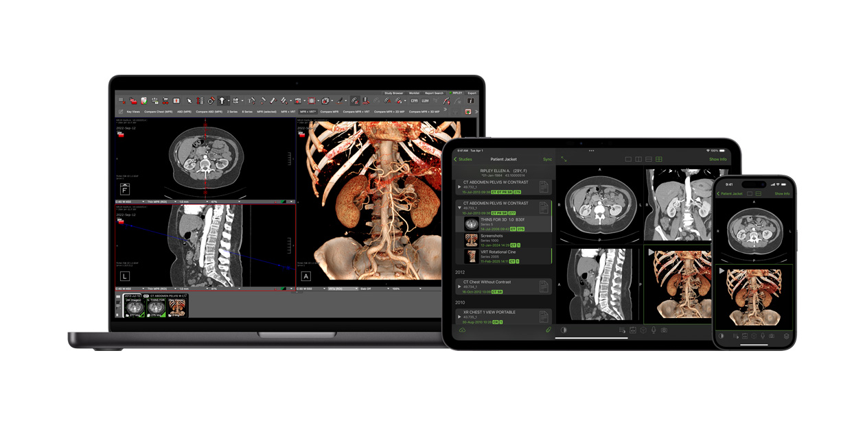 Software que muestra la app Visage, utilizada en radiología para interpretar archivos de diagnóstico de gran tamaño.